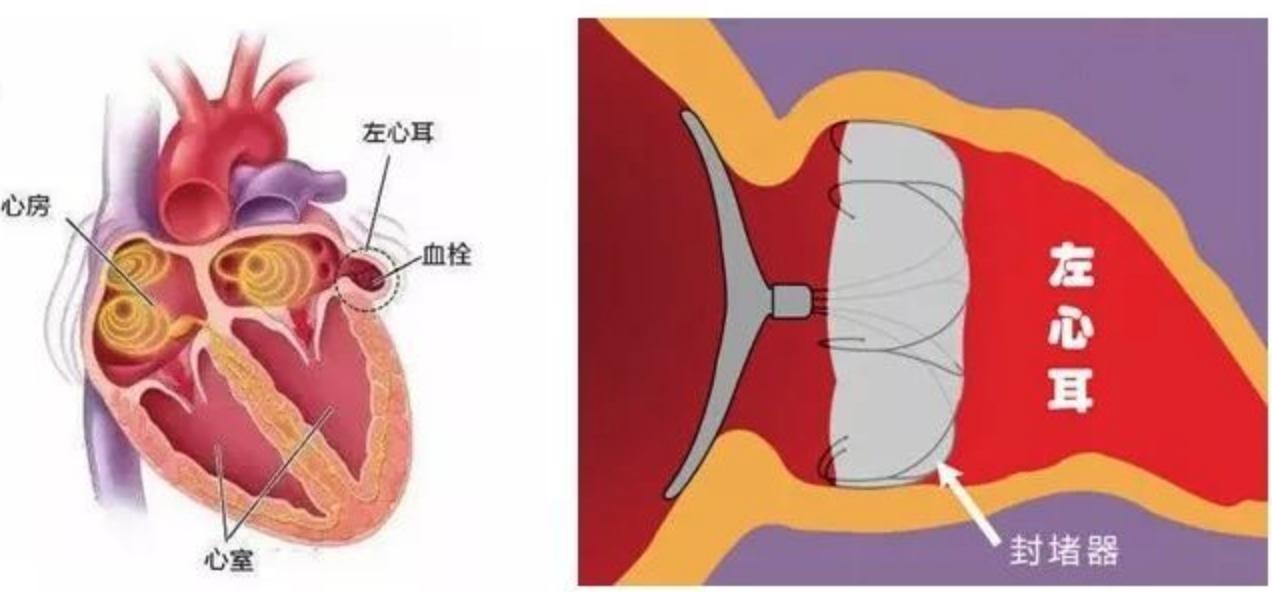 一颗心扑通扑通的狂跳图片,房颤是不是突然一阵乱跳