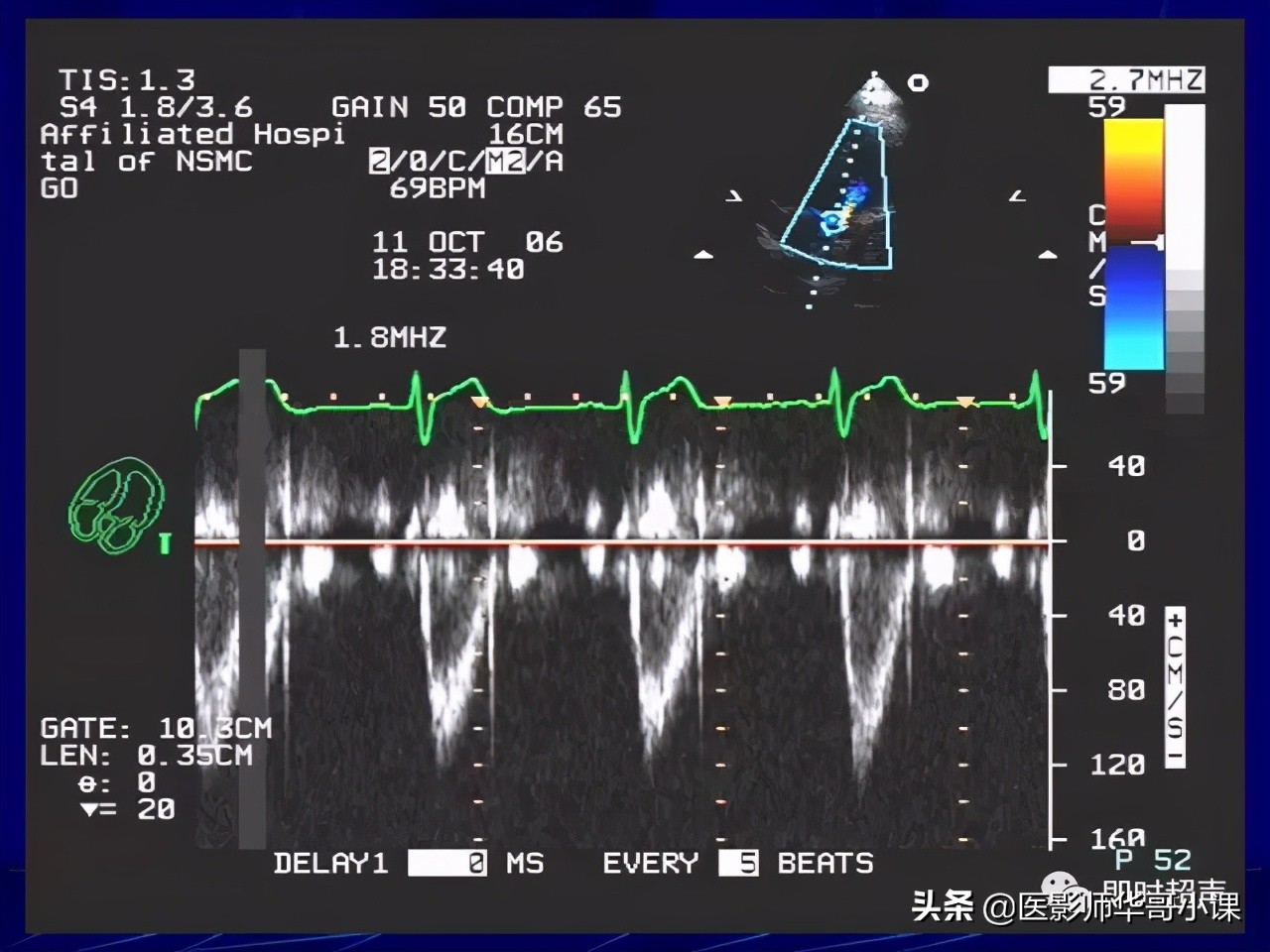 超声检查报告单讲解,超声图像检查