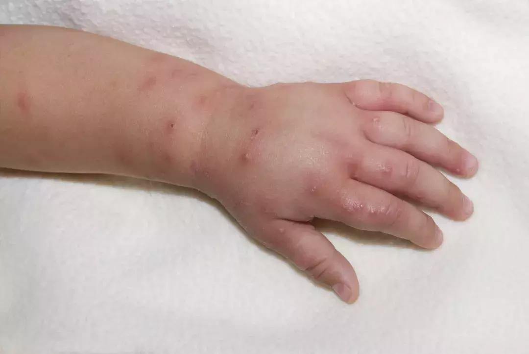 宝宝霜有激素吗,婴儿霜检出激素后续