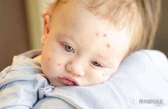 蚊香是最有效的驱蚊方式之一,蚊香驱蚊的正确方法