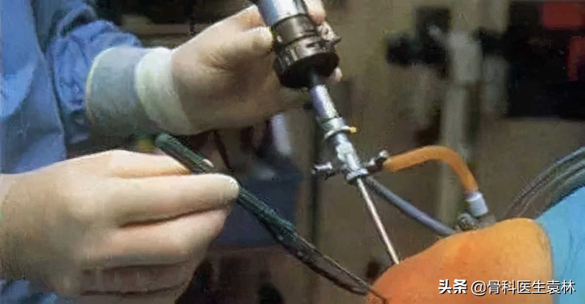 膝盖疼说是滑膜炎有什么膏药吗,膝盖疼说是滑膜炎怎么办