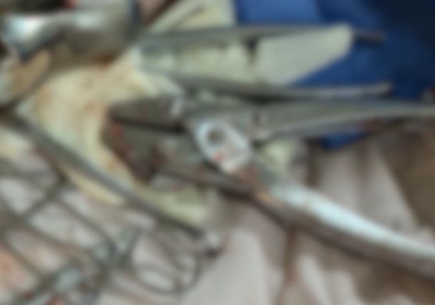 女子私密处竟塞入弹簧，原因令人哭笑不得