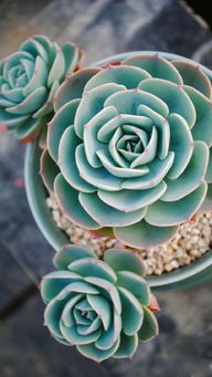 胆结石患者平时饮食要注意什么,胆囊炎和胆结石肾结石饮食注意啥