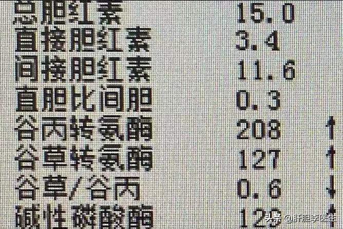 体检时转氨酶高怎么能快速降下来,转氨酶偏高怎么才能快速降下来