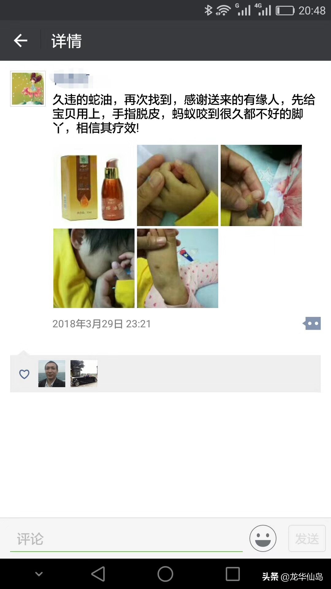 蟒蛇油使用案例与方法