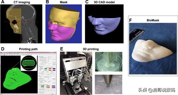 生物3d打印如何实现的,生物3d打印用什么材料