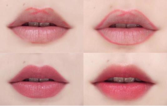 笑起来比较丑的唇形,唇形丑怎么改善