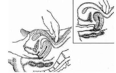 子宫“问题百出”，妇科检查到底做哪些？