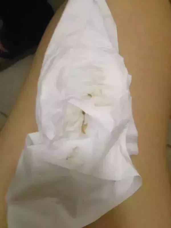 内裤的分泌物什么样是正常,短裤上有黄色的分泌物怎么办