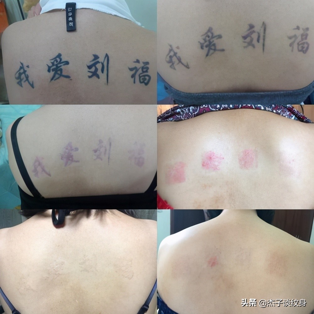 哪里洗纹身比较好一点,在哪里洗纹身较好