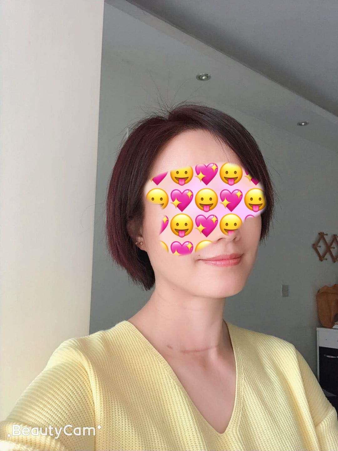 甲状腺问题和教师职业有关吗,甲状腺是老师的职业病吗