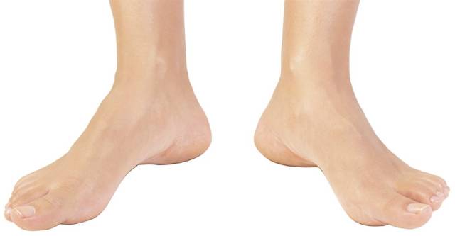 外八字脚会不会影响膝盖,跑步时八字脚产生原因及纠正方法