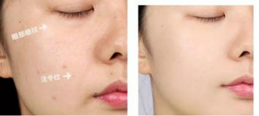 大牌美白精华液哪个好用又便宜,大牌祛斑精华液美白淡斑第一名