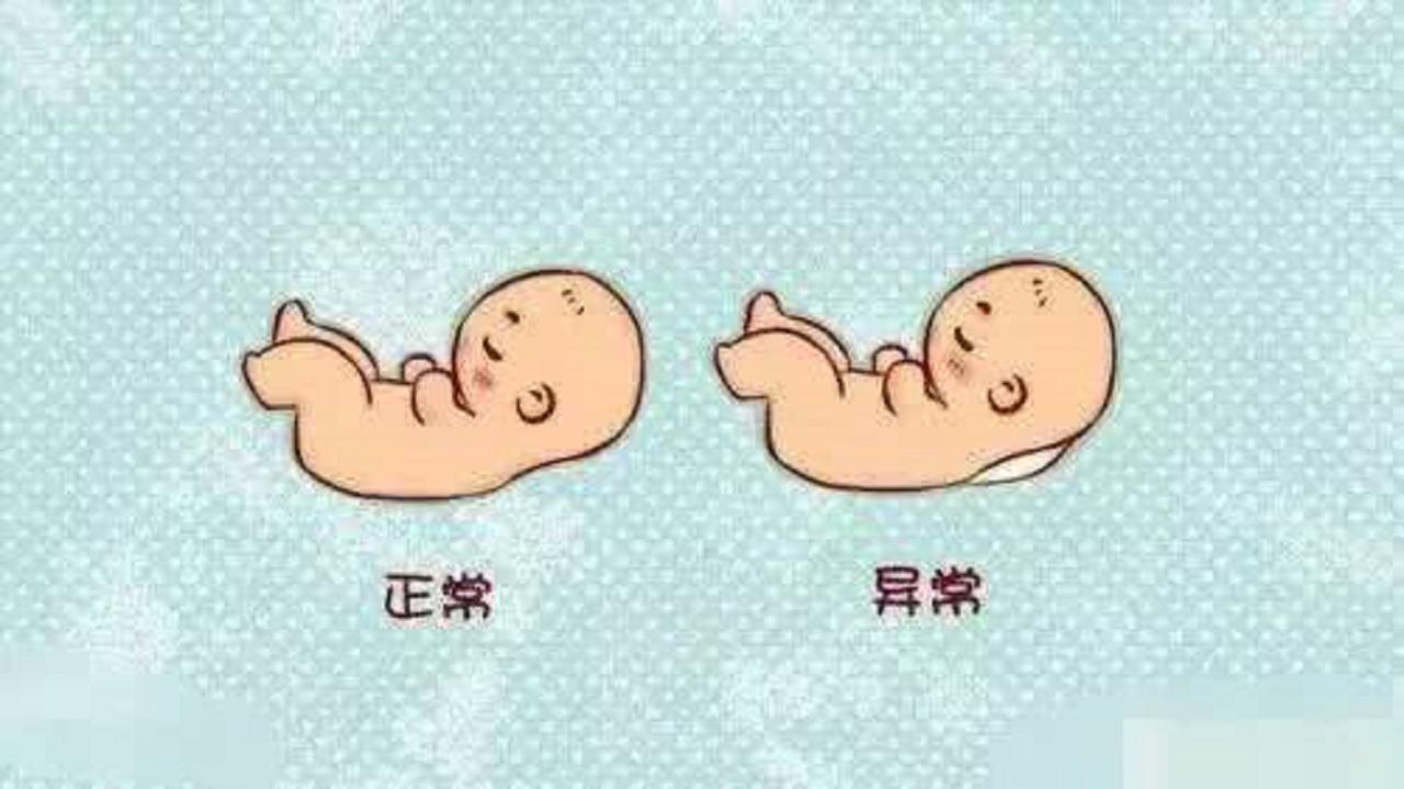 nt检查过后怎么知道胎儿的状况,nt筛查异常怎么办