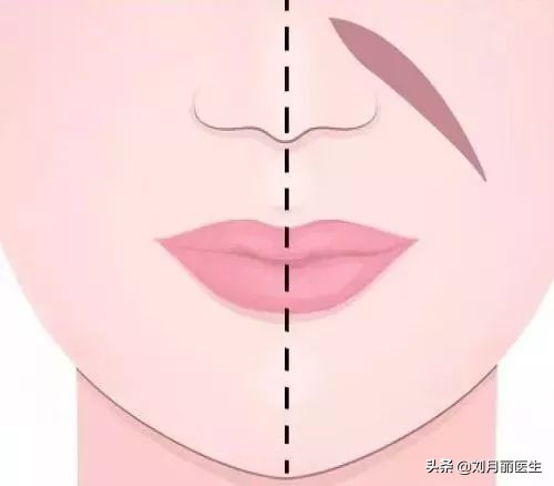 修复苹果肌改善法令纹,改善法令纹的面部运动