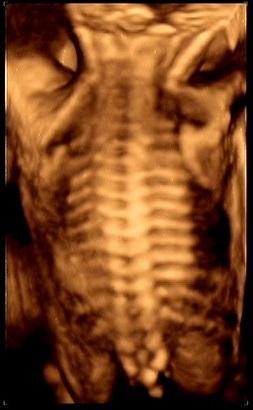 37周做四维彩超有必要吗,孕期四维彩超有必要做吗