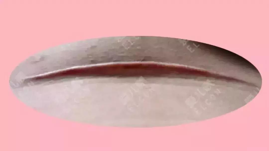 产后刀口又痒又痛的原因居然是这个?