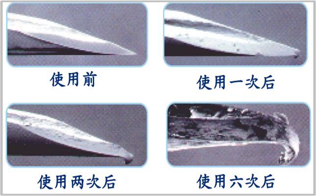 糖尿病28岁医生,29岁糖尿病肾病三期能治好吗