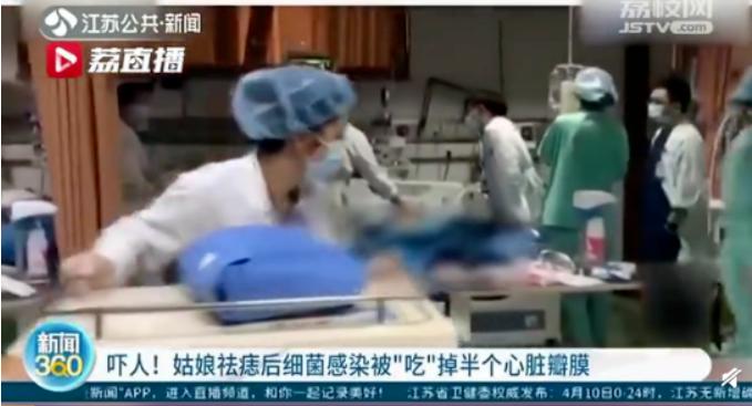 挑筋断骨切胃，那些为了美不要命的女人到底有多可怕