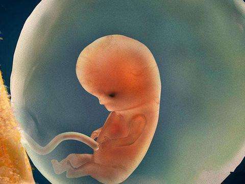 胎儿流掉后医生会怎样处理,自然流出来的胎儿怎么处理