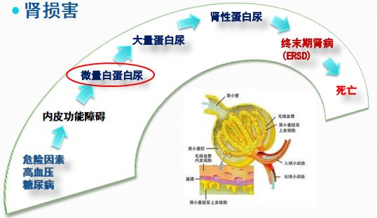 尿微量白蛋白80会伤肾功能吗,查尿微量白蛋白还要查肾功能吗