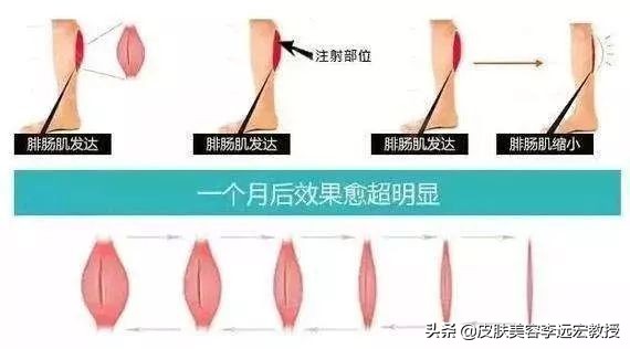 大腿小腿增粗怎么练,大腿粗小腿结实怎么办