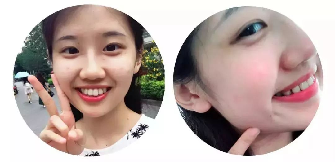 国家有关于牙齿的补贴吗,牙齿补贴报销政策