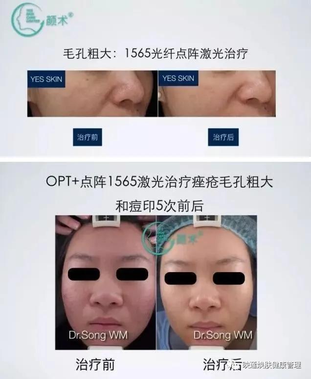 脸部皮肤严重缺水怎么调理,皮肤油光暗沉怎么办