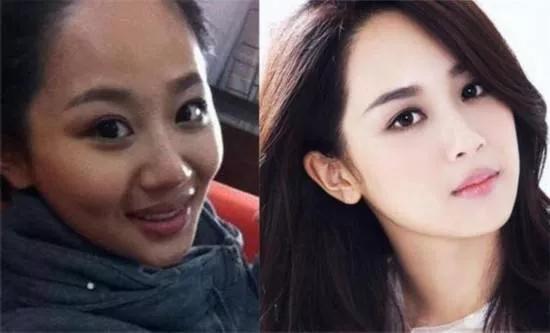 vc377美白淡斑精华旗舰店套装,BellaAurora美白精华