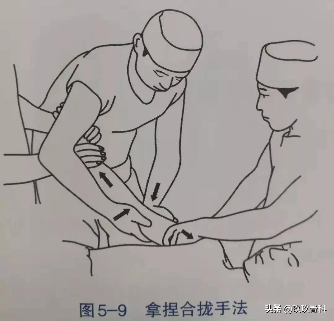 骨折手法整复术多少钱,骨折恢复手法视频教程