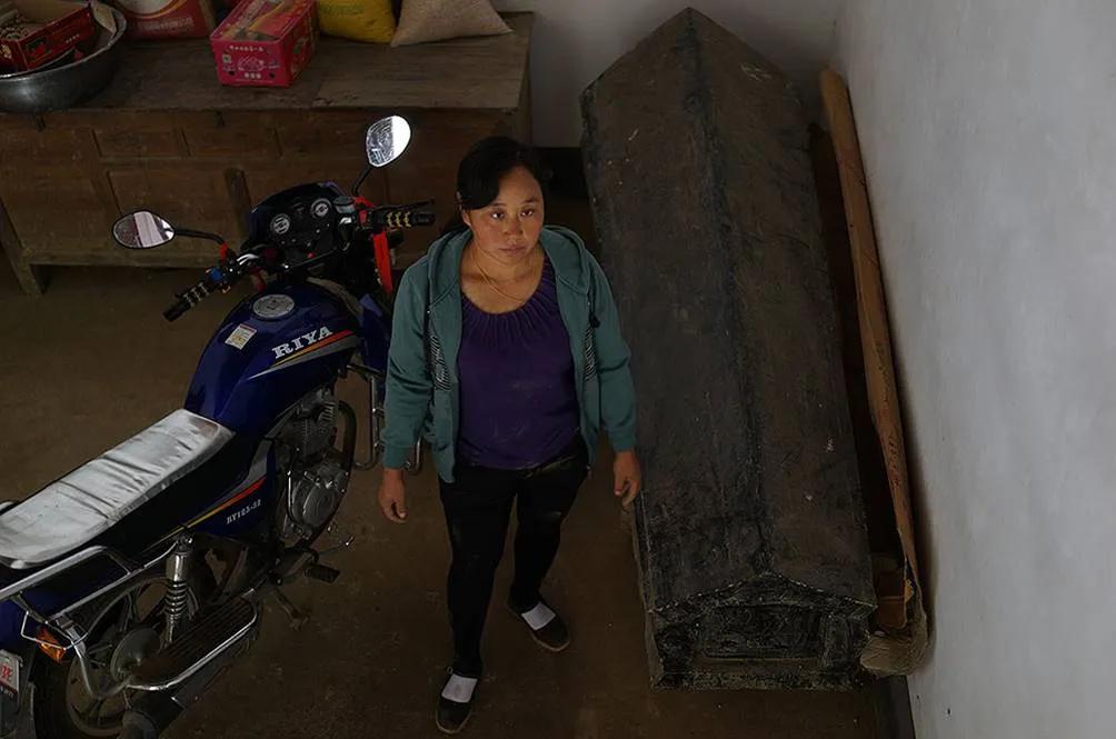 尘肺病是本世纪最严峻的问题,尘肺病发展到什么程度为一期