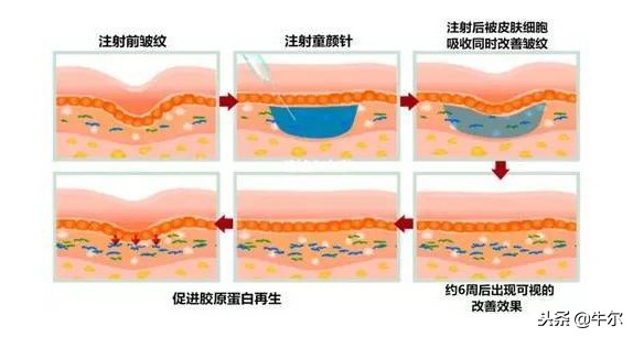 逆龄焕肤四大衰老祸首,逆龄重塑骗局