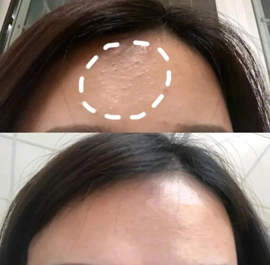 说了一万遍的闭口问题，今天就来说一说