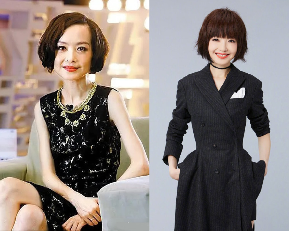 发际线高显老怎么办,发际线高最简单的补救方法