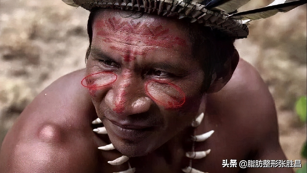 ps改善脸部皱纹方法有哪些,印第安皱纹怎么去除