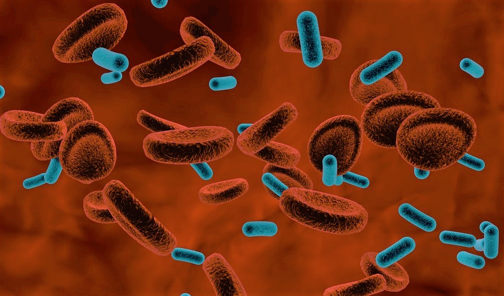 急性眼结膜炎一般病程是多少天,春季结膜炎的发病原理图