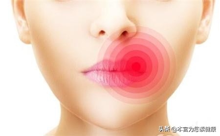 经常烂嘴角抹什么,经常上火烂嘴角怎么回事
