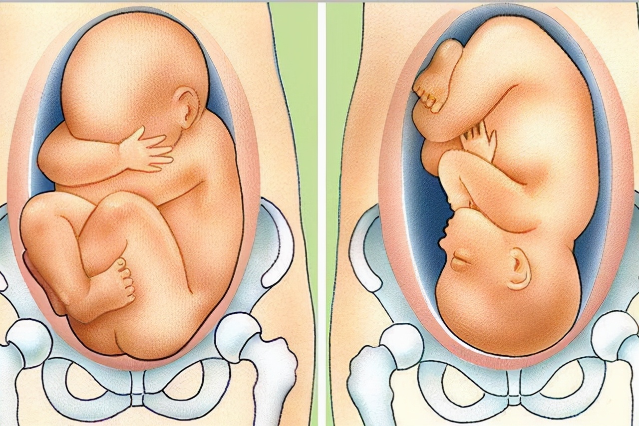 胎儿入盆充血,胎儿入盆了为什么还会顶着胃