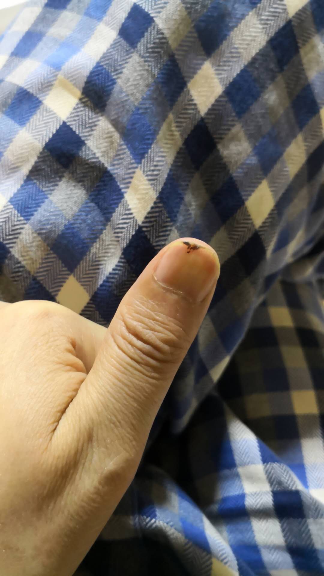 指甲一年换新几次？摔了一跤才得到了真实答案，纠正了想当然