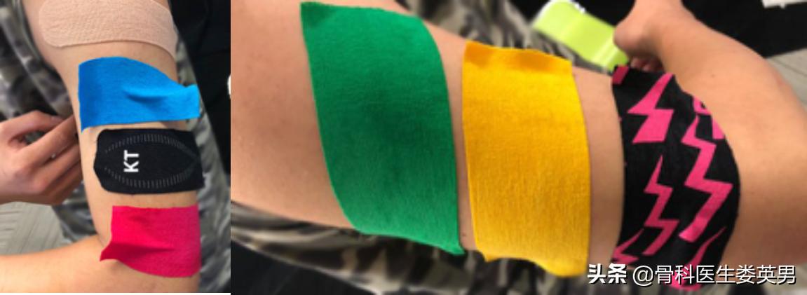 李宁牌肌效贴,李宁肌内效贴儿童