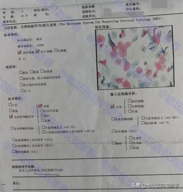 HPV“复发”与宫颈炎症是否有关？医生告诉你真相