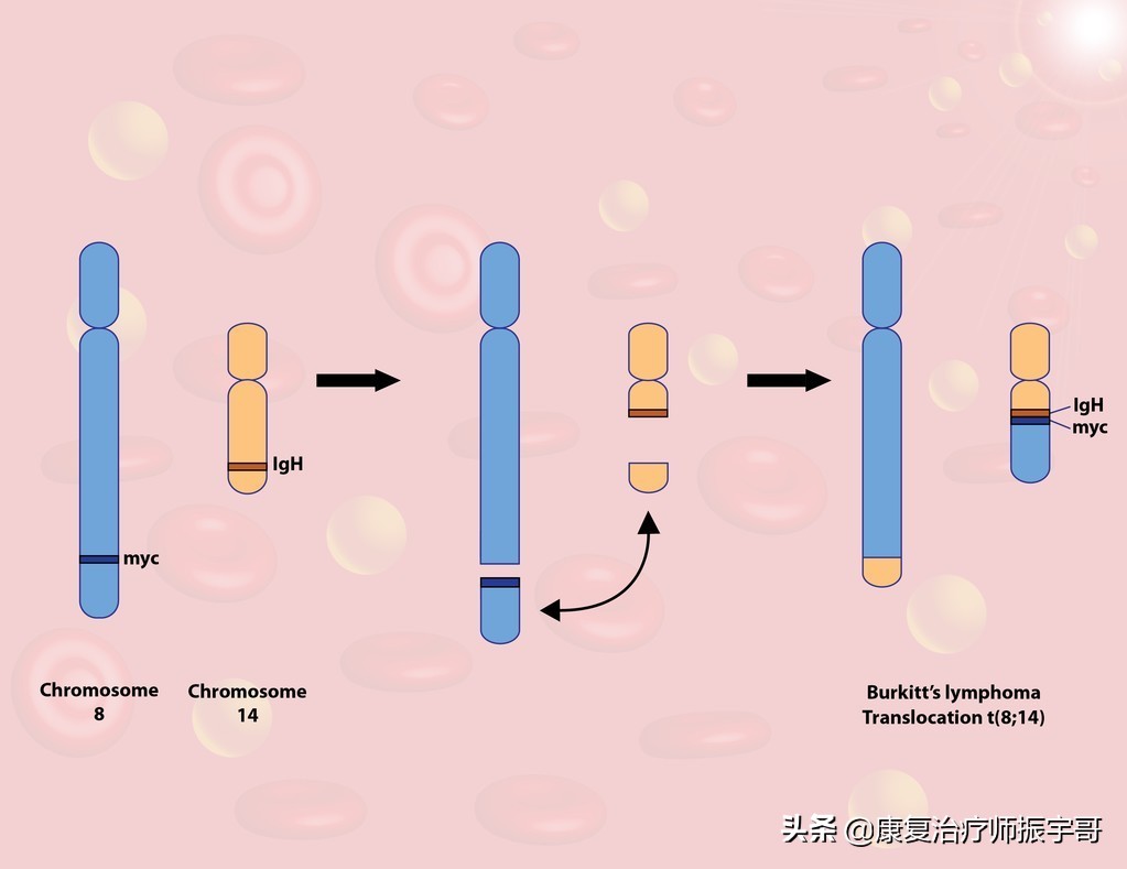 先天基因缺陷罕见病叫什么,基因出问题有治愈的可能吗