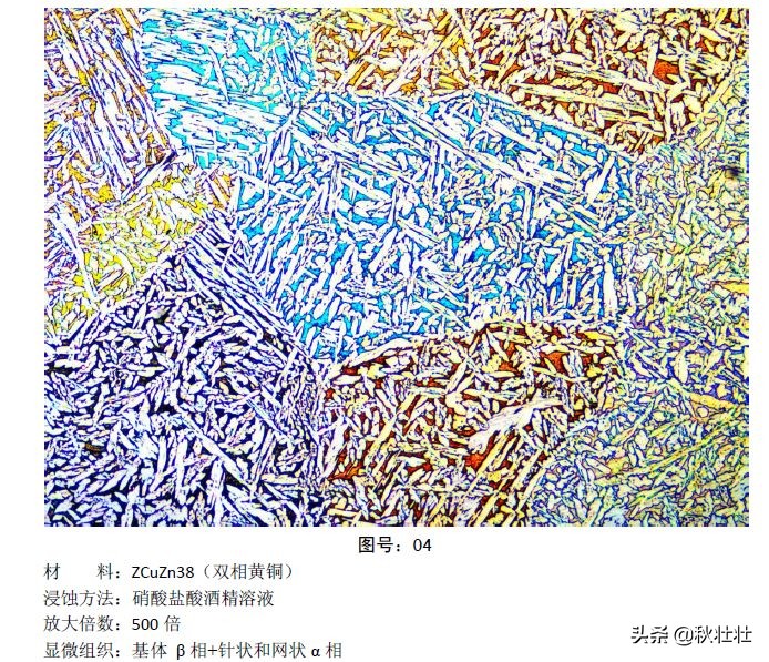 马氏体和奥氏体金相图片,马氏体和珠光体金相区别