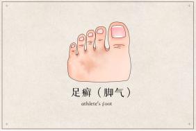 告别足部问题,足部一直有问题该怎么办