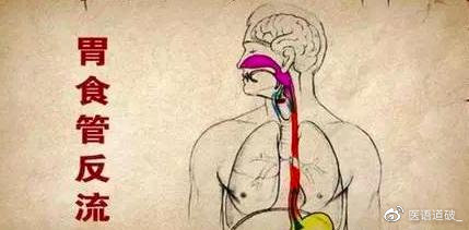 甘肃刘维忠中医治反流性食管炎,中医怎么治疗反流性食管炎