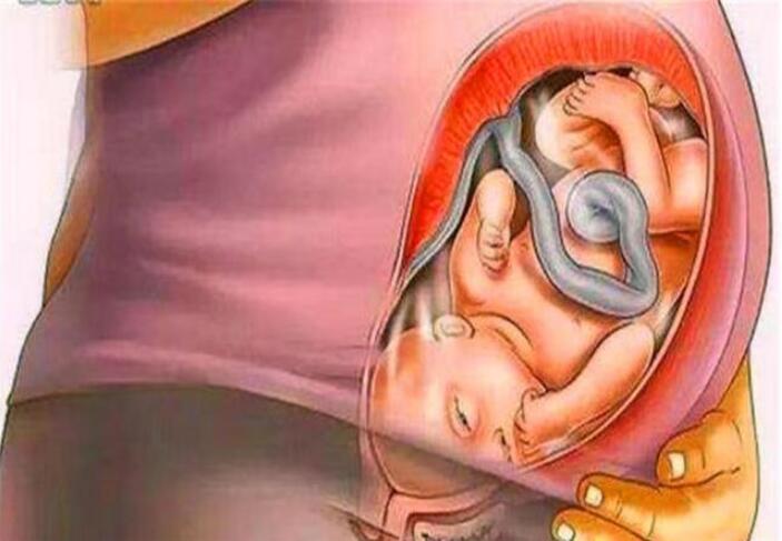 孕18周孕妇内脏器官图,孕妇怀孕之后内脏变化图