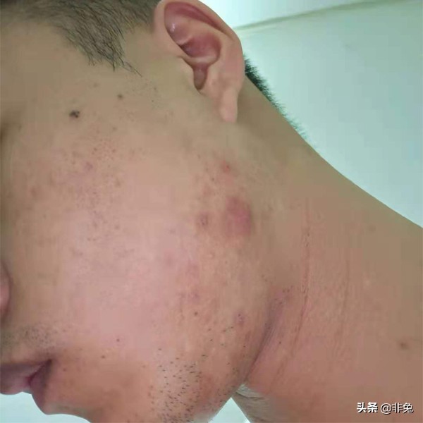 非兔fw03测评,非兔魔手测评