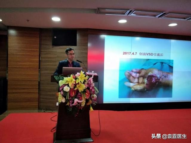 共话学术-肌骨超声引导下冲击波联合PRP治疗骨不连及骨关节炎