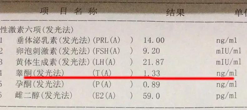 NCAH型多囊的案例分析