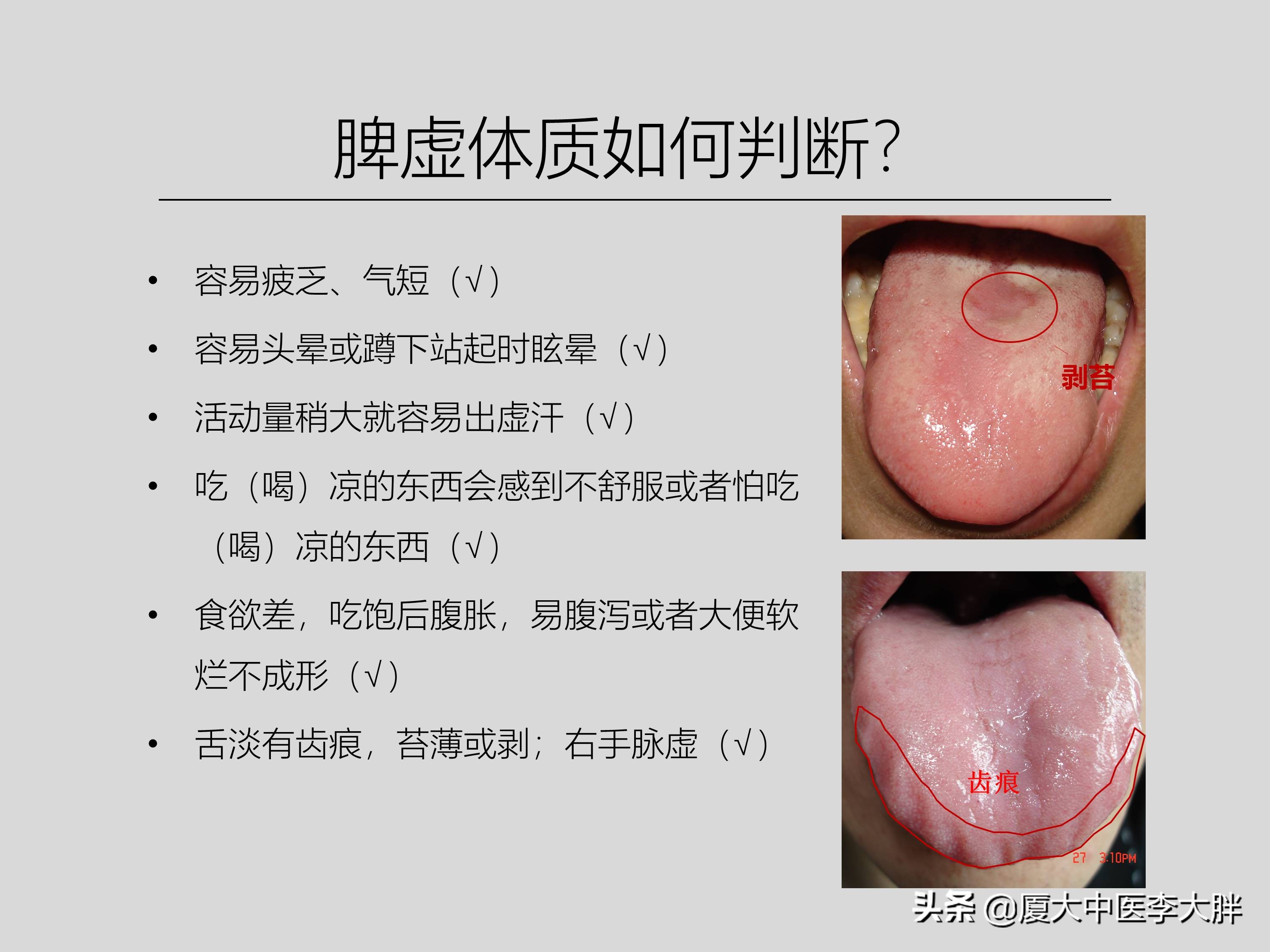 幽门螺旋杆菌哪些必须治疗,什么食疗方法治疗幽门螺旋杆菌